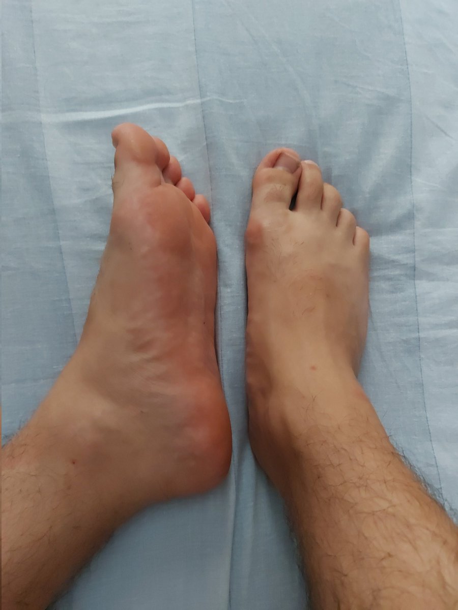 MasterCalabrese's tweet photo. Chi vuole questo splendio43 calabrese? 😈 #feet #piedi #italian #italiano #master #padrone #feetmaster #feetfetısh #cash https://t.co/ktaep0kQ51