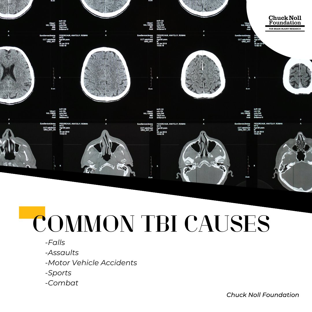 Traumatic Brain Injuries (TBIs) can happen in an instant—and not just on the field. 🧠

We’re committed to funding research that improves how we understand, diagnose, and prevent brain injuries—no matter where they happen.

#BrainInjuryResearch #TBIawareness #ProtectTheBrain
