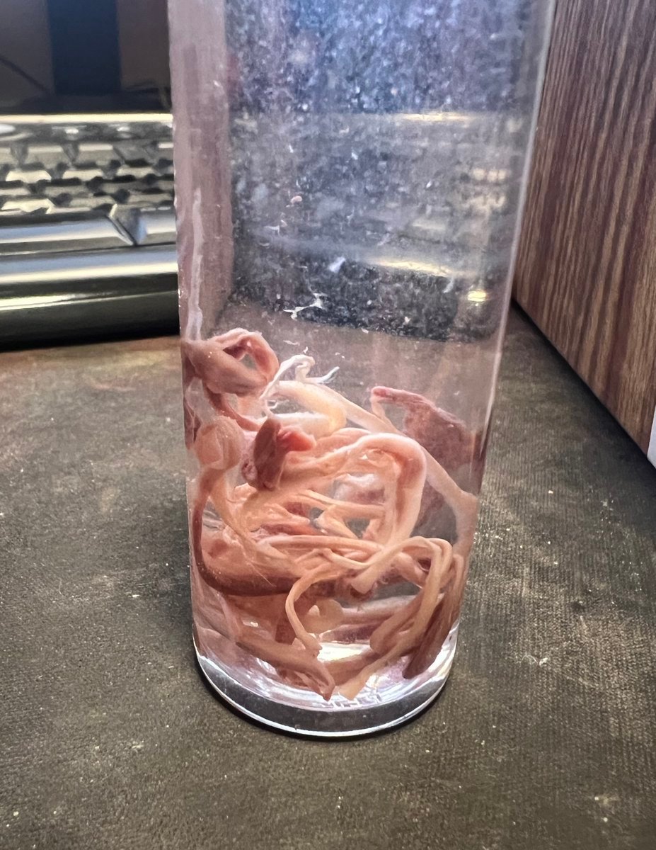 I haven't heard from TVP regarding my report on the activities of our favourite undertake since last October.

I emailed my police contact over a week ago politely asking for an update, but no reply as yet. Sigh.

He's still at the body fiddling game (or so he claims).