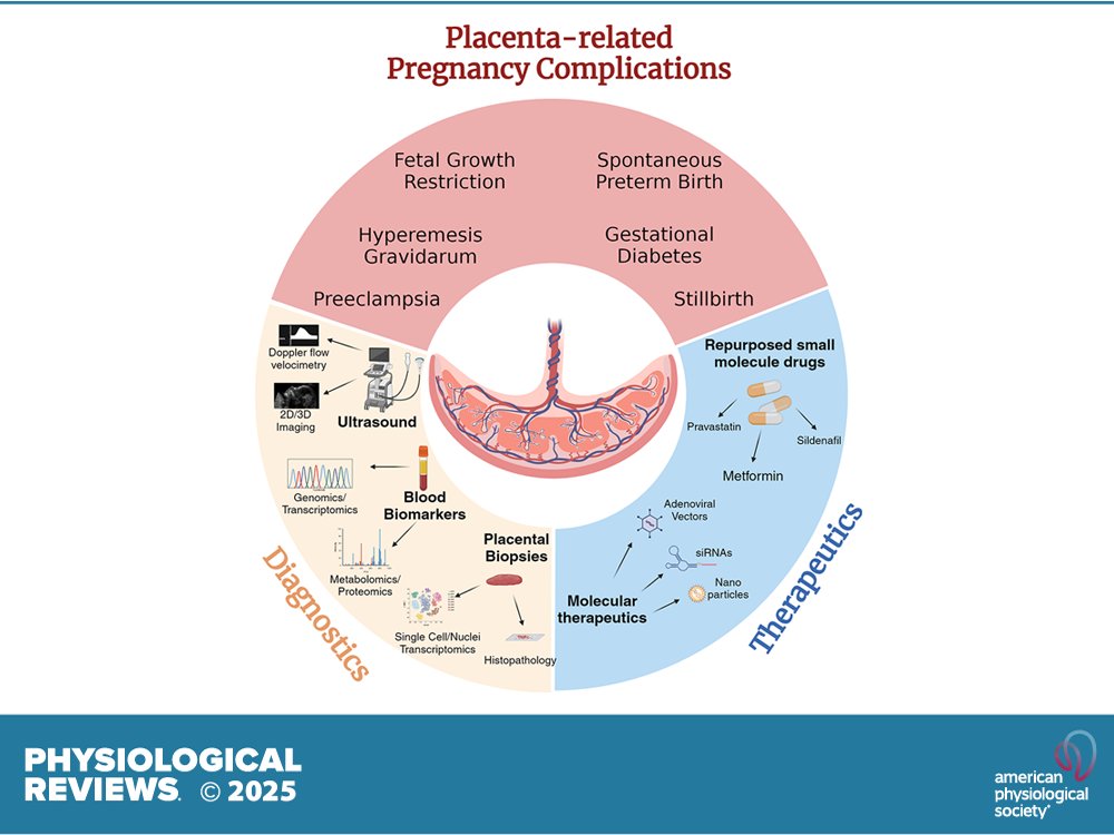 physiolrev's tweet image. 🆕Review article from @physiolrev, The human placenta and its role in reproductive outcomes revisited
Irving L. M. H. Aye, et al.
ow.ly/ZKGa50WmYzA
#development #pregnancy #preeclampsia @irv_aye @Cambridge_Uni