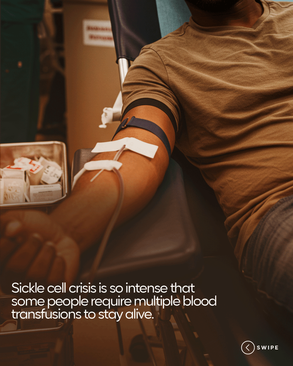 sicklecellnig's tweet photo. Crisis when properly managed should not happen too frequently.
To learn more, visit us at National Sickle Cell Centre,Opp Lagos University Teaching Hospital (LUTH), Ishaga Road, Idi-Araba, Surulere, Lagos.
#SickleCellFoundationNigeria
#SickleCellTips https://t.co/rT2nX7wRNS