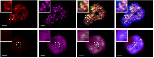 ProstateCell's tweet image. New findings from researchers in China underscore the pivotal role of YY1 in the hypoxia/HIF-1伪 pathway in tumor-associated macrophages and support the targeting of YY1 for treating #ProstateCancer.
馃摎 Read the @NatureComms study: go.nature.com/4eF3C5r