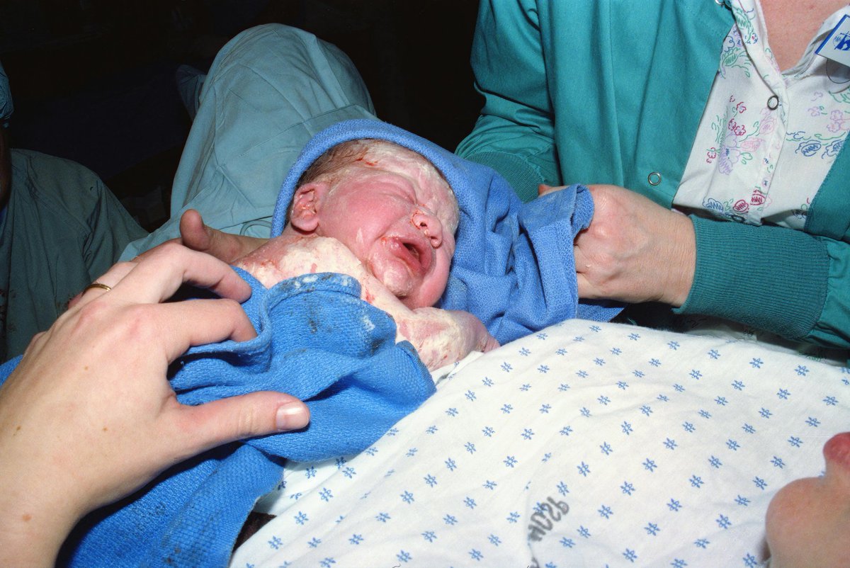 👶💖 A fragile life was hanging in the balance — a baby born through a complicated delivery where every second mattered.
Thanks to your love and donations, you guys gave this little one a safe start in life.
You didn’t just donate — you saved a future.
#HopeBridge #MiracleBaby