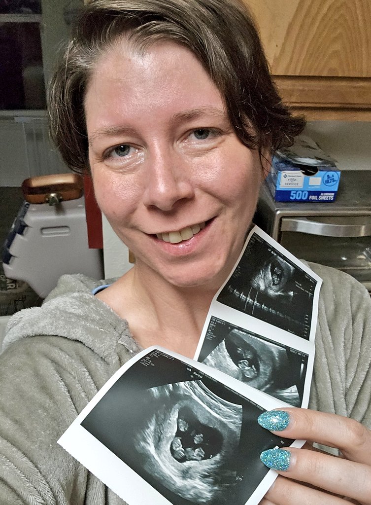 Big announcement for 2025. 
Im pregnant!
 9wks during Anthrocon. Its one of the big reasons I wasn't out and about fursuiting as much. Was too tired after working the tables all day.

Was holding off announcing publicly till the ultrasound day.