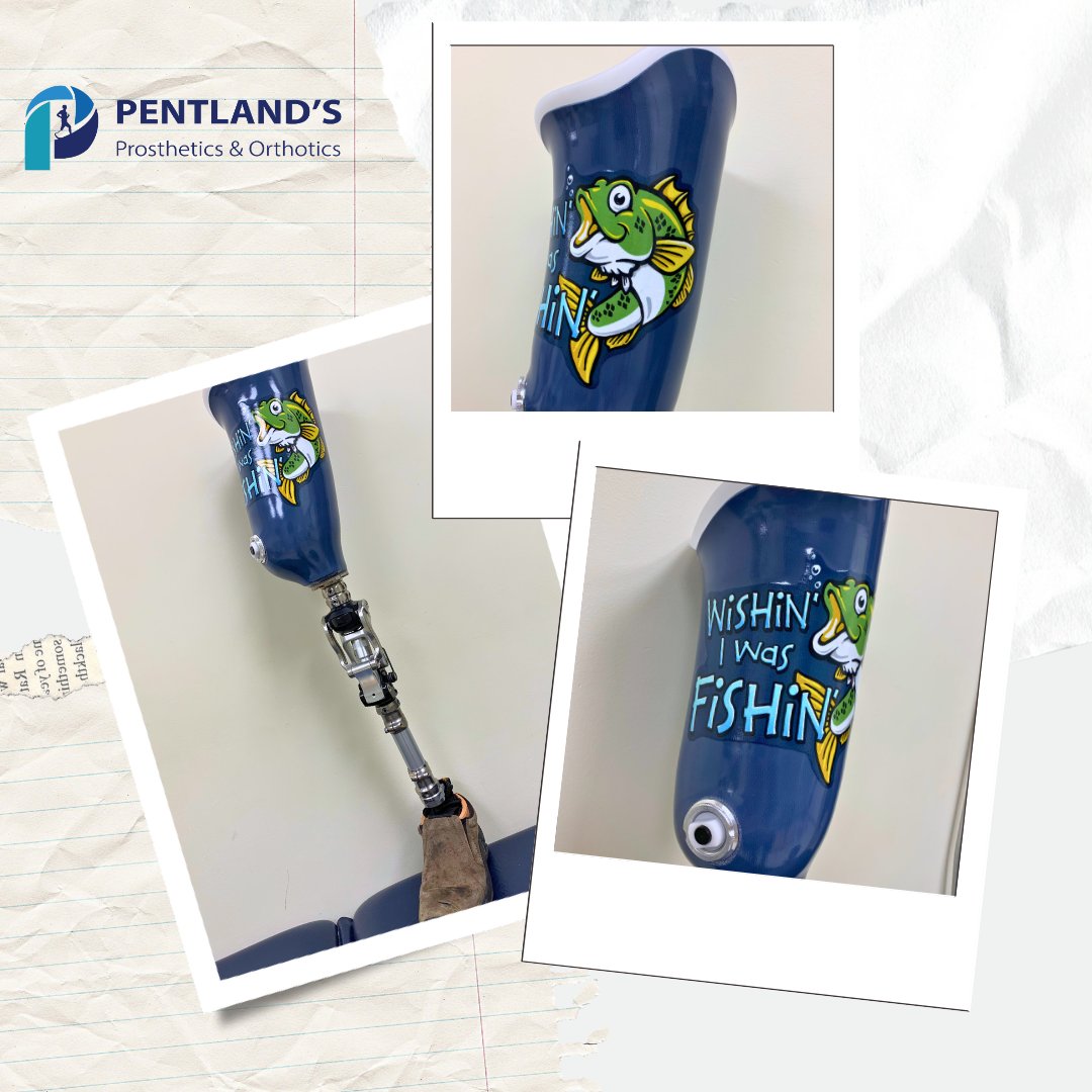 pentland_s's tweet photo. "Wishin' I was Fishin'" Our Prince George team crafted a custom socket with some serious personality, featuring a proud catch and the perfect motto for any fishing enthusiast! ๐๐ช
#AmputeeArtist #ProstheticArt #pentland_s #Prosthetics #WishinIWasFishin #CustomProsthetics https://t.co/maimZFJBt3