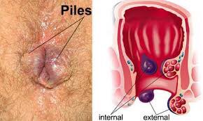 NY_amankwaa's tweet image. The disease.                         The remedy