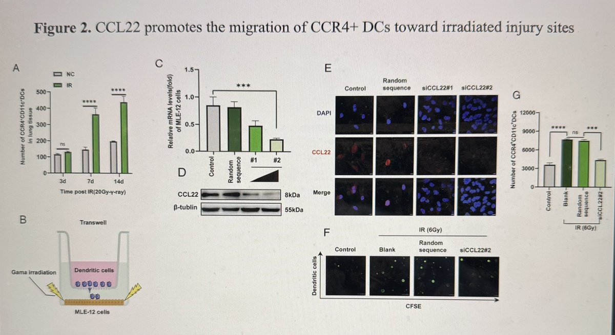 Wafik S. El-Deiry, MD, PhD, FACP (@weldeiry) on Twitter photo Great presentation this morning at #eldeirylab meeting by <a href="/BrownUniversity/">Brown University</a> Pathobiology PhD student Jillian Strandberg on role of CCL22 in radiation pathobiology. Jill previously demonstrated systemic anti-CCL22 therapy has some protective effects towards radiation pneumonitis. Great presentation this morning at #eldeirylab meeting by <a href="/BrownUniversity/">Brown University</a> Pathobiology PhD student Jillian Strandberg on role of CCL22 in radiation pathobiology. Jill previously demonstrated systemic anti-CCL22 therapy has some protective effects towards radiation pneumonitis.