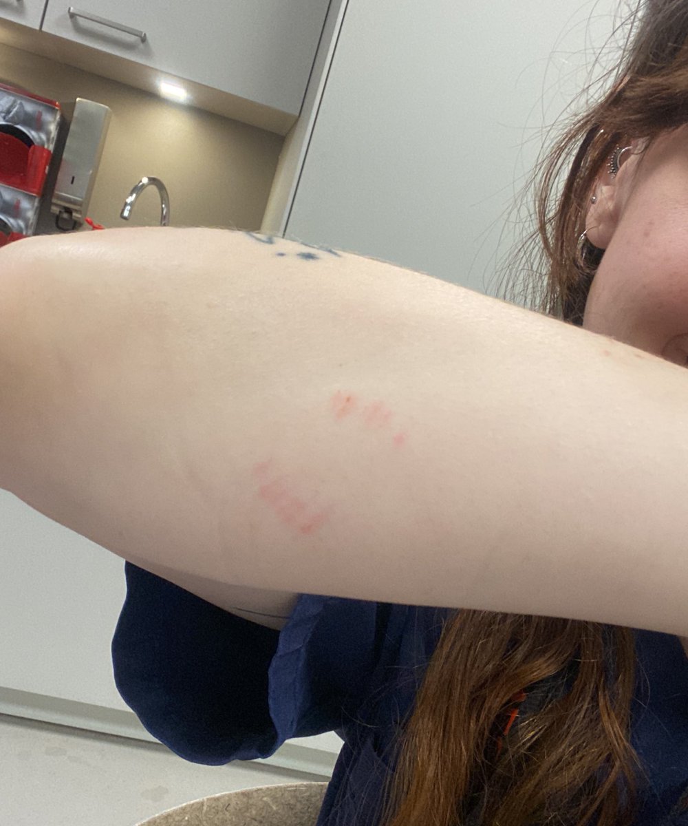 vssleis's tweet image. seal prison for Astro.
that little demon chewed on my arm while trying to feed his quarantine buddies.
#アザラシ幼稚園