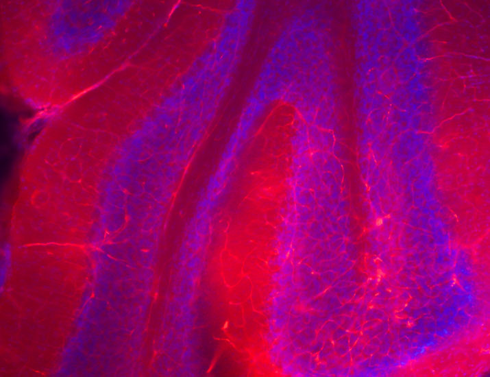scisignal's tweet image. The enzyme MDM2 supports the blood-CNS barrier and endothelial cell proliferation by acting through the proteins norrin and frizzled 4 and NCAPH, according to new work in mice that hints MDM2 inhibitors could impair these barriers. @junge_harald @UMNews scim.ag/46vAStK