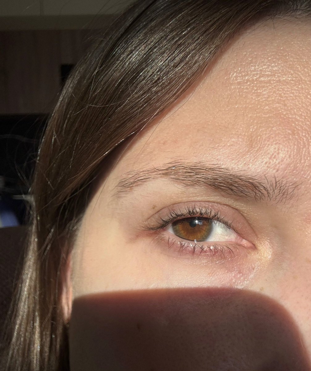 только в 28 лет узнала, что на солнце у меня меняется цвет глаз (с краю немного зеленые)