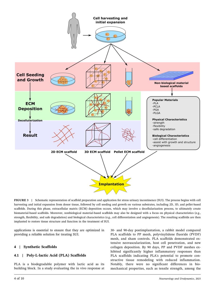 Ilaha Isali (@ilahaisali) on Twitter photo Excited to share our new paper exploring biodegradable scaffolds and their potential role in SUI treatment! We highlighted promising strategies for optimizing scaffold properties and enhancing clinical outcomes <a href="/NAUjournal/">Neurourology &Urodynamics</a> <a href="/WCMUrology/">Weill Cornell Medicine Urology</a>
Link ⏬
pubmed.ncbi.nlm.nih.gov/40581871/ Excited to share our new paper exploring biodegradable scaffolds and their potential role in SUI treatment! We highlighted promising strategies for optimizing scaffold properties and enhancing clinical outcomes <a href="/NAUjournal/">Neurourology &Urodynamics</a> <a href="/WCMUrology/">Weill Cornell Medicine Urology</a>
Link ⏬
pubmed.ncbi.nlm.nih.gov/40581871/