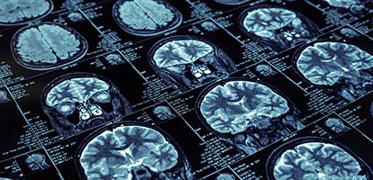 pfragiskatos's tweet image. At @WesternU this morning where I learned more about partnerships between brain researchers and local organizations working with seniors. Brain research can help improve care in so many ways. Thank you to those involved in this work and to Dr. Shawn Whitehead for the invitation…