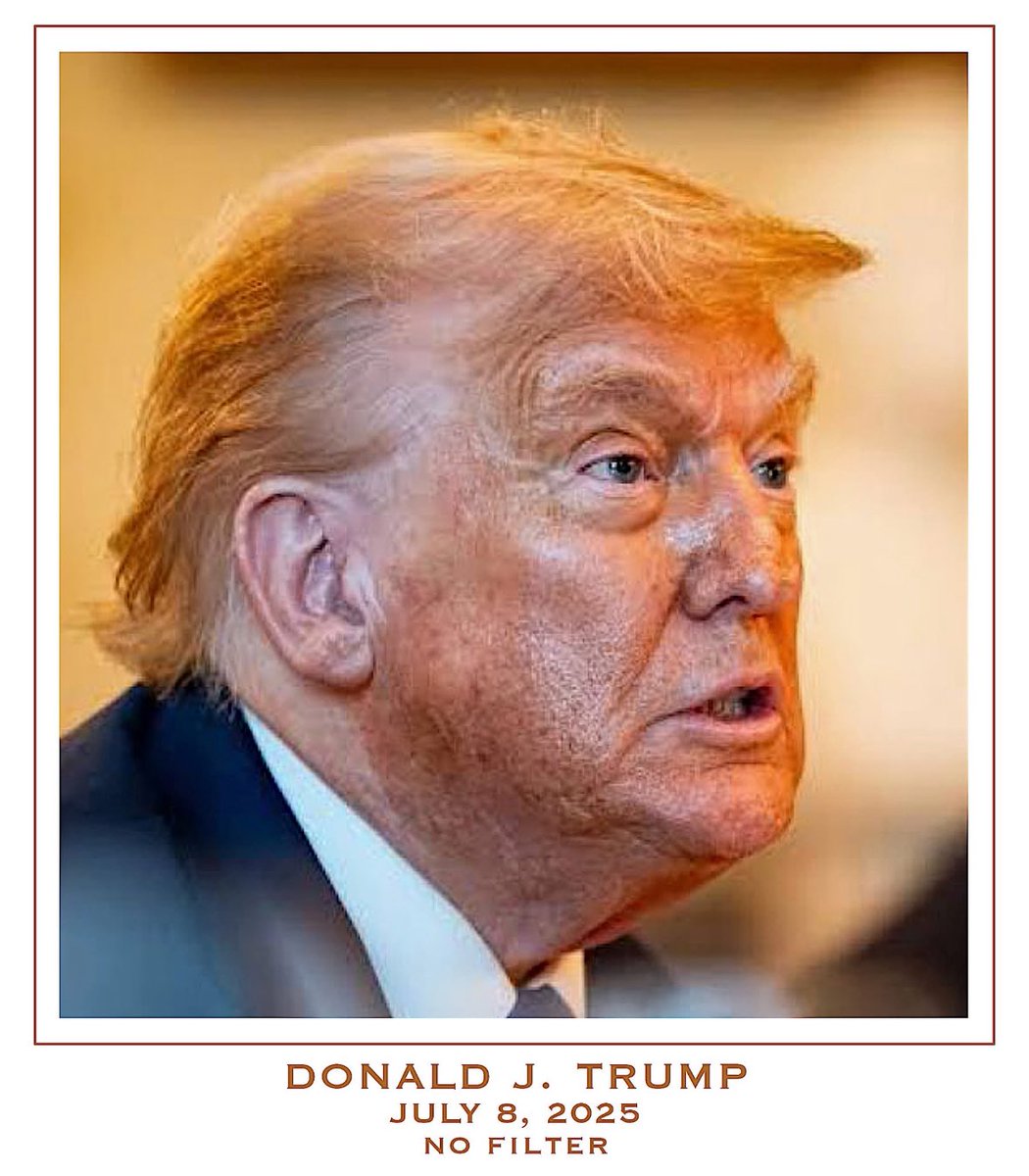 He’s a Malignant Narcissist, Pathological Liar, sociopath, cheater, stealer, grifter, money hungry, power hungry wanna be king and dictator. His inner dark, malicious being shows through on the exterior. He’s a very sick individual physically, mentally, emotionally, spiritually.