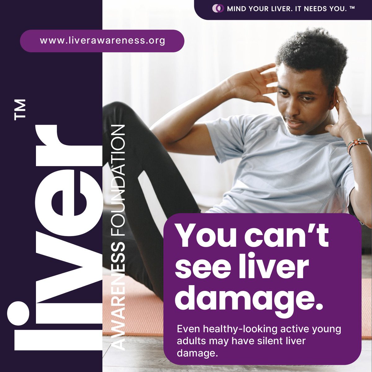 LiverAwareness's tweet image. You can’t see liver damage.
Even healthy-looking young adults can have silent liver damage.
Mind Your Liver. It Needs You.™
#LiverAwareness #MindYourLiver #LiverHealth #MASLD #ThisisLAF #YoungAdults