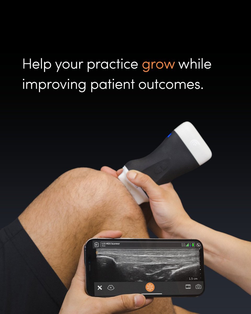 Better care. Faster answers.
Reimagine the physical exam with Clarius wireless ultrasound—trusted by 30,000+ clinicians.
✅ Bladder volume
✅ OB biometry
✅ Lung + heart in minutes
✅ Built-in AI
Learn more → clarius.com/primary-care/
 #POCUS #PrimaryCare