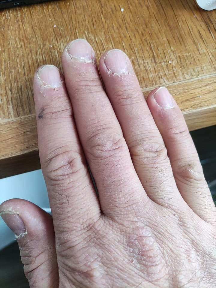 selimtemo's tweet photo. Sekiz yıldır bu el de diğer el gibi baş eğmeyen bir adamı hayatta ve ayakta tuttu. Ne alçağa açıldı ne barbara yalvardı. Beyaz lekeli tırnaklarla birlikte düşünce emeğinden kol emeğine geçti. Ama okumak ile yazmaktan, düşünmek ile halkın yasına katılmaktan vazgeçmedi. Şimdi işte büyük bir üniversitenin yeni hocası olarak havada yuvarlaklar çize çize konuşacak ve her şeye şaşırmaya devam edecek.

Yıllar önce şöyle bir dize yazmıştım: "açlıkla eğitilmiş ellerim, kara ellerim." Yaşıyorum bir ömrü. Halkının ve katıldığı sınıfın mücadelesine layık oldu desinler, yeter!

Bizi efendilerden, zalimlerden, hainlerden ayıran şey, her an yeniden başlamamızdır. Kazanınca da yenilince de. Değişince de gelişince de. 

Ne demişti o pembe bir gül gibi gülümseyen çocuk: "Başareceğiz!"

#Başareceğiz