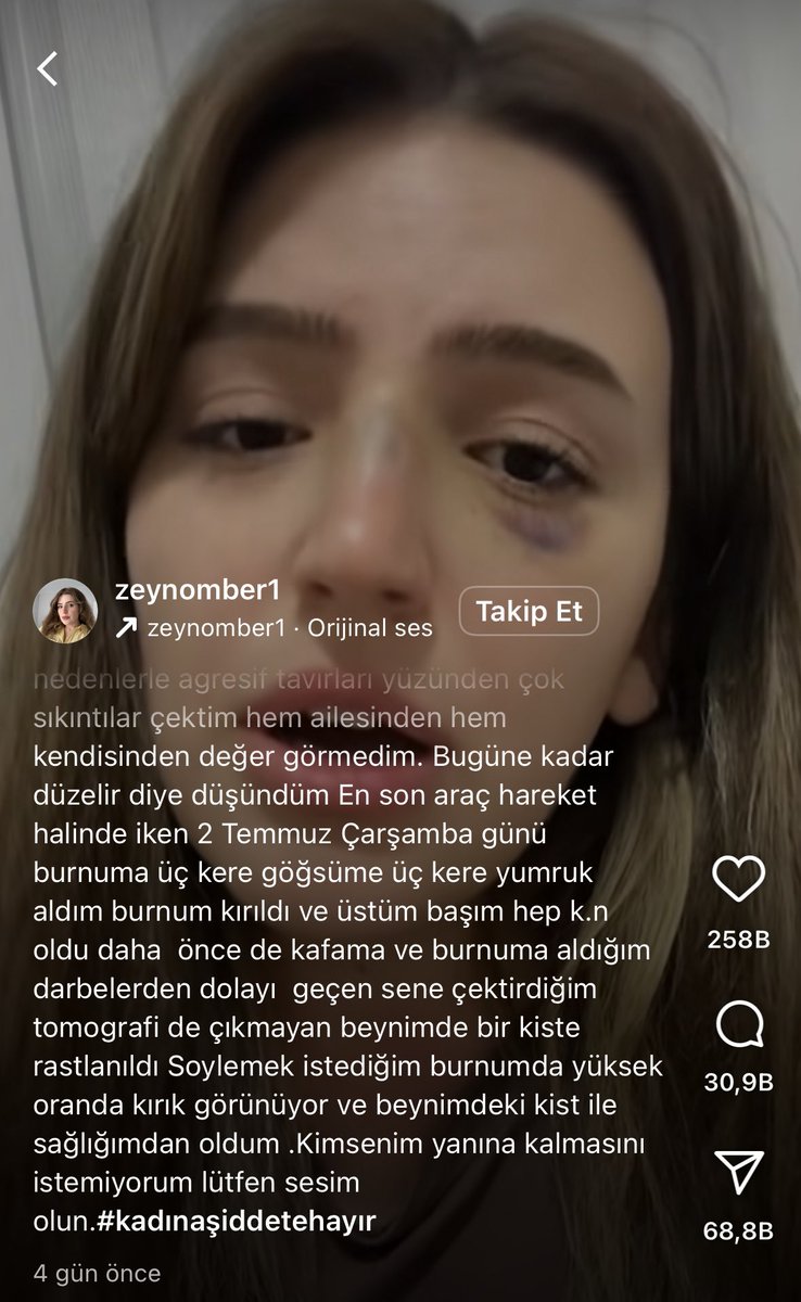 Zeynep için adalet istiyoruz