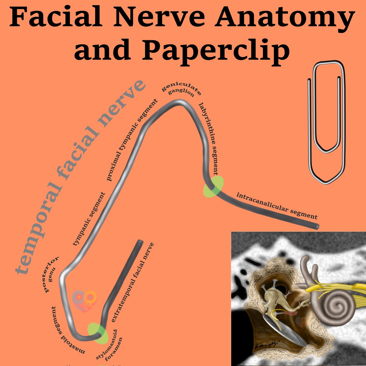 drharunyildiz's tweet image. Facial Nerve Anatomy and Paperclip