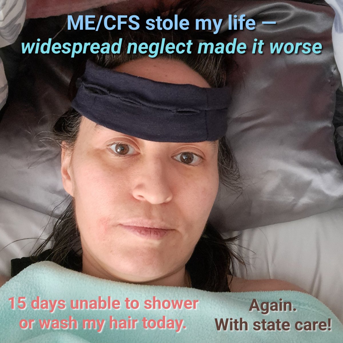 #MEcfs took my health —society’s neglect took everything else.
Lack of research.
Lack of treatments.
Lack of medical education.
Years of delayed govt support.

If the system had shown up for me, I wouldn’t be this sick today.

#MyalgicEncephalomyelitis #LongCovid #MillionsMissing