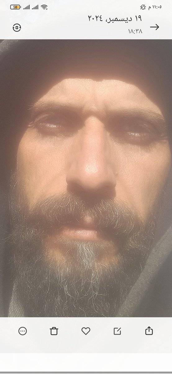 Adelsaeed222's tweet image. I am in severe pain and need urgent surgery within a week. It costs $1,000. I only received $30. I hope to get the money before the end of the week.😣
chuffed.org/project/109350…