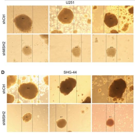 A new study from researchers at Wuhan Union Hospital identifies MSH2 as an oncogenic factor in #glioma.💡 

#MSH2 drives stemness and progression through regulation of the Wnt/β-catenin pathway, and may serve as a potential therapeutic target. bit.ly/3GARw0E