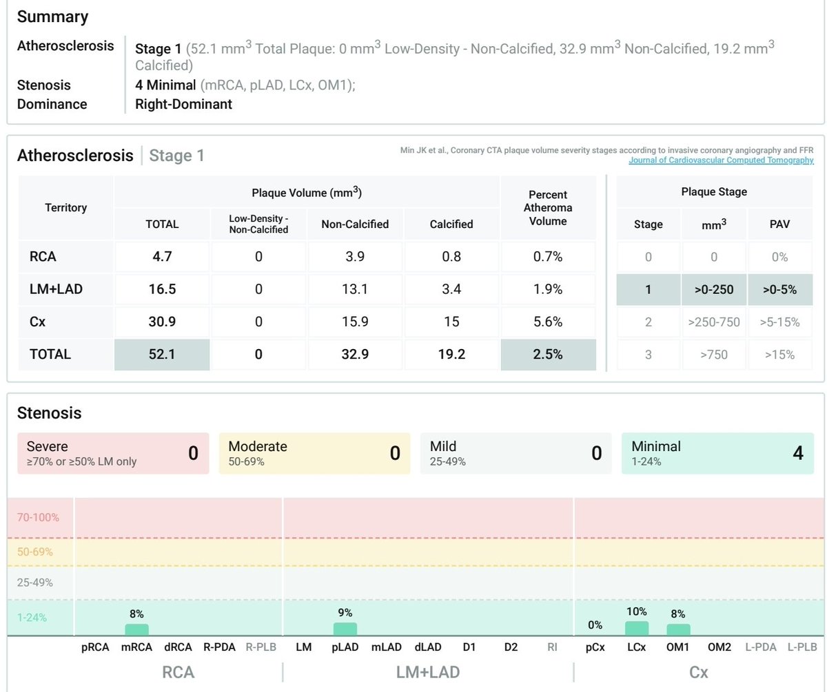 Darius Sharpe (@mursedarius) on Twitter photo <a href="/theproof/">Simon Hill MSc, BSc (Hons)</a> Major props for putting your results out there! Very few influencers actually do!
Your results are similar to mine, except my LDL has been >175 mg/dL since I was 24. I'm 41, and this scan was last year at age 40. CAC at age 39 was 44, and the repeat last year was 30.1, but it <a href="/theproof/">Simon Hill MSc, BSc (Hons)</a> Major props for putting your results out there! Very few influencers actually do!
Your results are similar to mine, except my LDL has been >175 mg/dL since I was 24. I'm 41, and this scan was last year at age 40. CAC at age 39 was 44, and the repeat last year was 30.1, but it