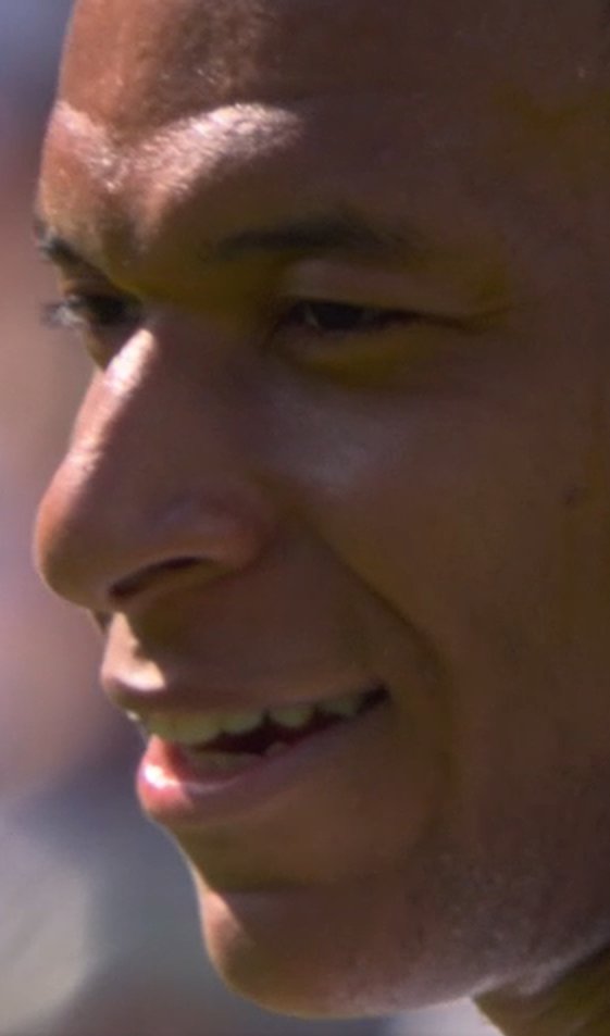 bzai57's tweet image. autiste