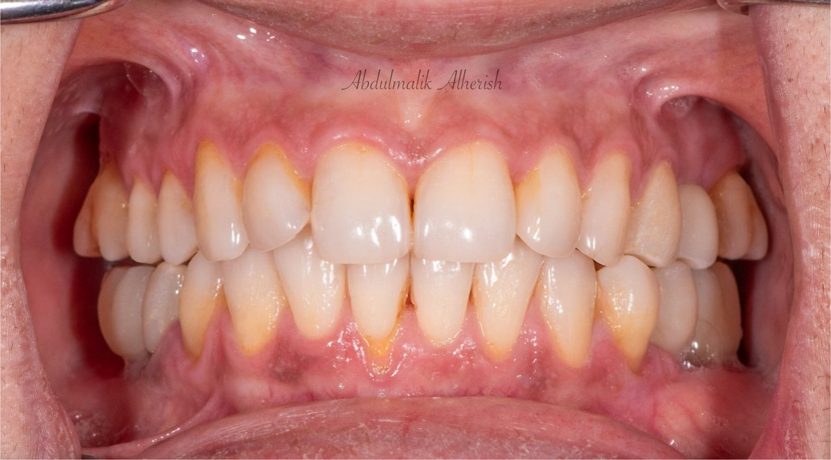 Abdulmalik tweet media