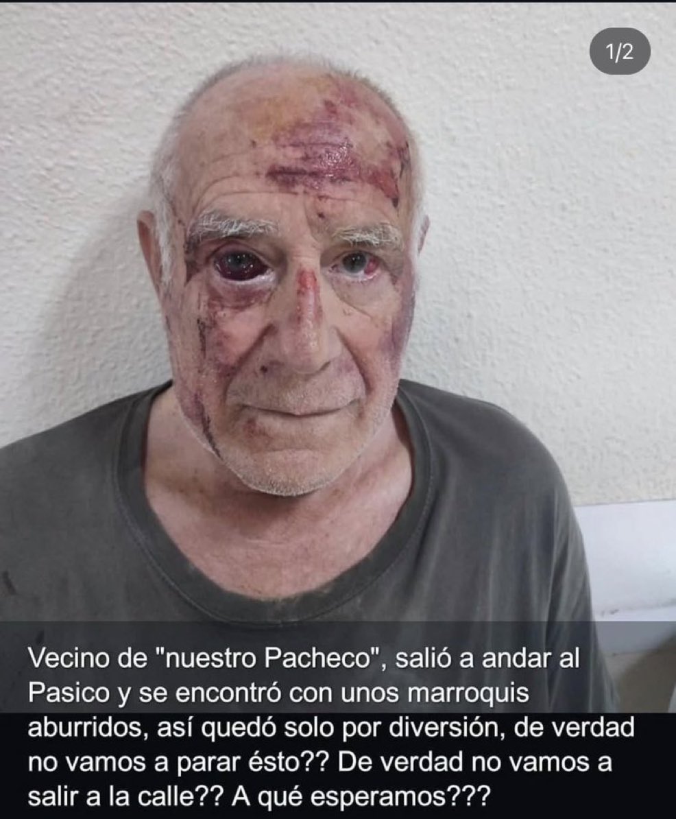 I hate sharing this news and this picture.

A Spanish man left his house to walk his dog in Spain, and a group of North Africans beat him up out of boredom.

This is the Spain the socialists have created for us.

SEND THEM HOME!!!!
