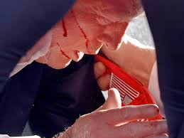 No blood on his right palm, wrist, or cuff 
He just got shot in the ear
He clutched his ear
Do people honestly believe this was a real assassination attempt?
It's fake as fuck!
The ear is extremely vascular in other words has a rich blood supply.
A high velocity round would have
