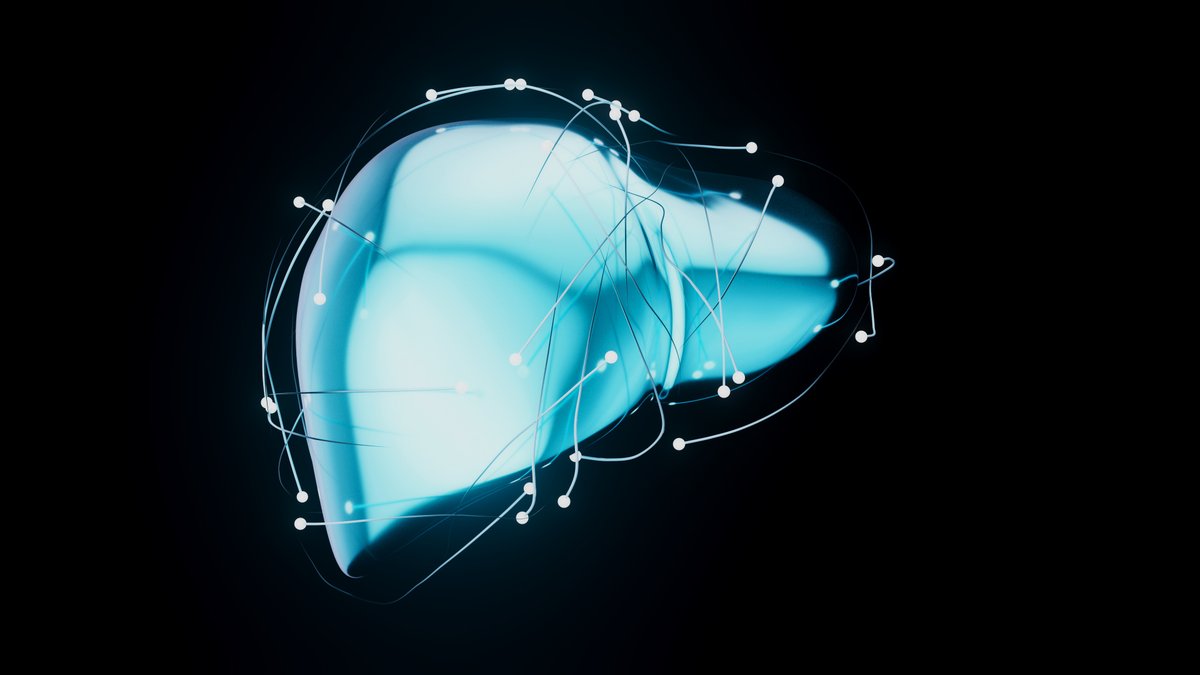 MedCentral (@medcentralmd) on Twitter photo New real-world data: In #MASLD, #SGLT2 inhibitors cut cardiac arrest risk by 34%, HF by 13%, acute #LiverFailure by 30%, #Cirrhosis by 10% vs non-use.
May offer dual organ protection — but RCTs needed to confirm.
bit.ly/40LppTd #CardioTwitter <a href="/SomayaAlbhaisi/">Somaya Albhaisi, MBBCh, MPH, FACP 🗝️🇵🇸</a> <a href="/ramziw_/">Ramzi Ibrahim, MD</a> New real-world data: In #MASLD, #SGLT2 inhibitors cut cardiac arrest risk by 34%, HF by 13%, acute #LiverFailure by 30%, #Cirrhosis by 10% vs non-use.
May offer dual organ protection — but RCTs needed to confirm.
bit.ly/40LppTd #CardioTwitter <a href="/SomayaAlbhaisi/">Somaya Albhaisi, MBBCh, MPH, FACP 🗝️🇵🇸</a> <a href="/ramziw_/">Ramzi Ibrahim, MD</a>