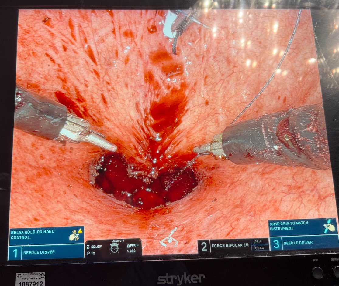 For your next SP TV—&gt; after Rocco stitch with the camera in the above position, hit camera below to invert. 

Voila a ❤️