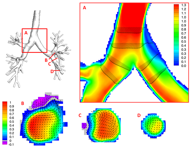 Tecplot's tweet image. When you're working with millions of experimental data points, it's crucial to be able to visualize large 3D data sets to understand the dynamics of flow. This Tecplot 360 visualization shows inspiratory flow in human airways. #visualization #CFD #fluiddynamics