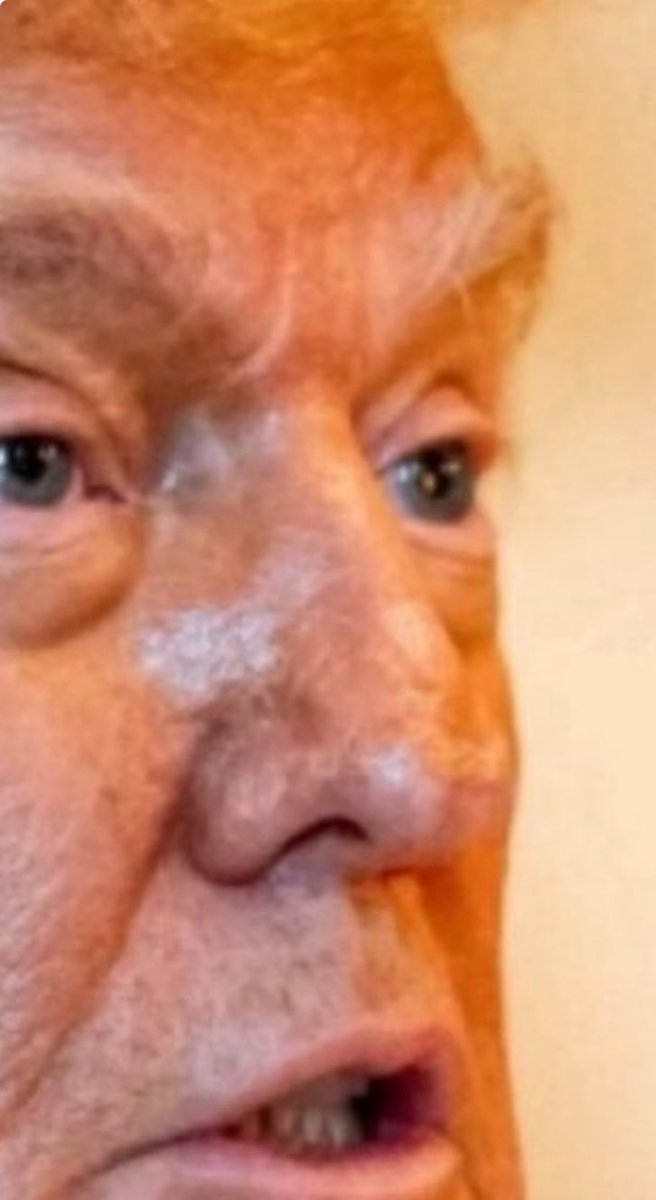 What’s wrong with Trump’s nose?