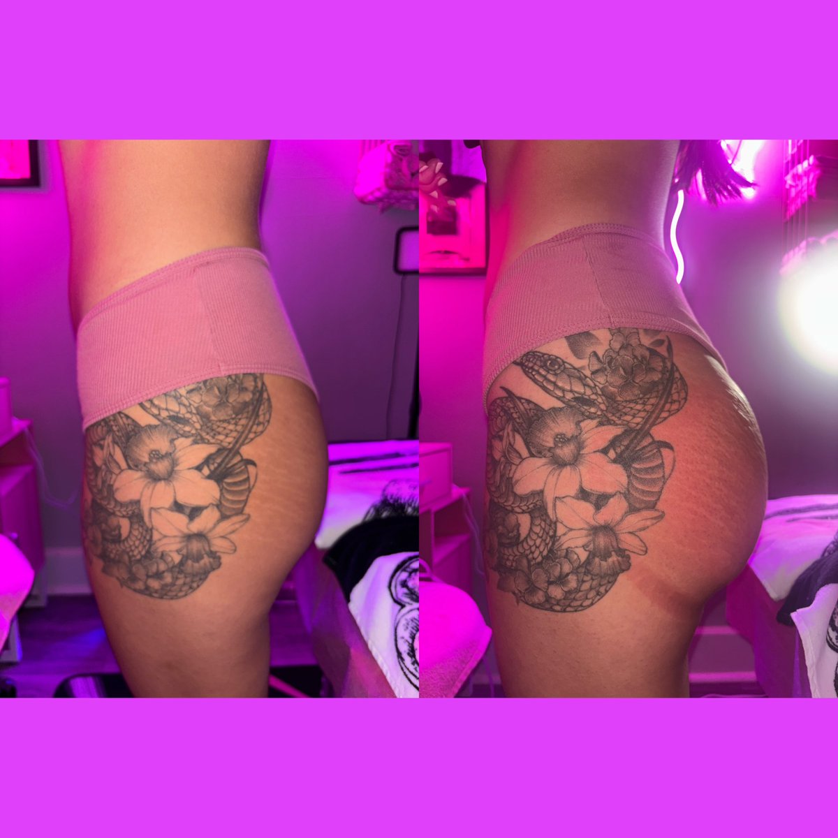 EXOTICMAMISNOW's tweet photo. Non-Invasive BBL Session 1 #bbl #vacuumtherapy #booknow #losangeles #viral https://t.co/OaPNkqg0g9