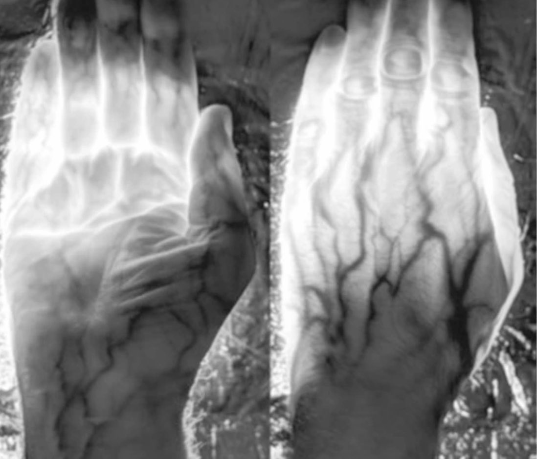 Very cool paper. “Longer wavelengths in sunlight pass through the human body and have a systemic impact which improves vision” I have known the senior author Glen Jeffery since the mid 90s and he’s always done very interesting work. Another beauty here. 
nature.com/articles/s4159…