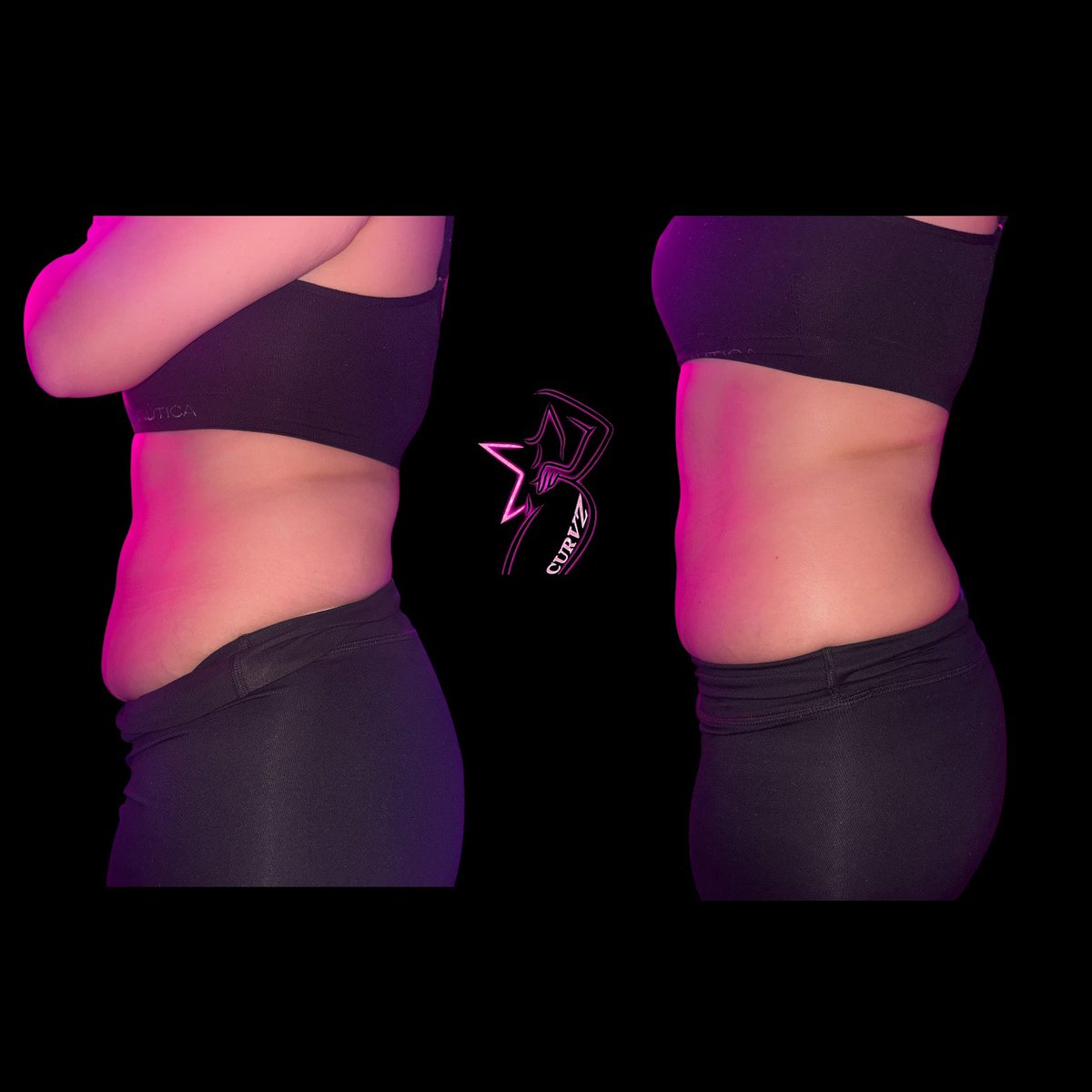 EXOTICMAMISNOW's tweet photo. Body Sculpting Session 1💫 #bodysculpting #booknow #losangeles #viral https://t.co/GtLnQI0hBC