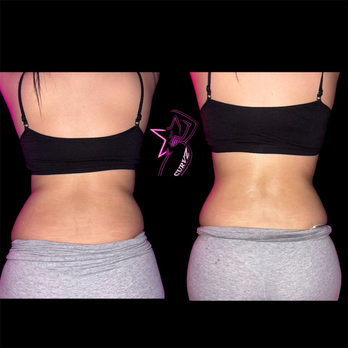 EXOTICMAMISNOW's tweet photo. Body Sculpting Session 2⭐️ #bodysculpting #booknow #bodypostivity #viral #losangeles https://t.co/LTjtj3mrE2