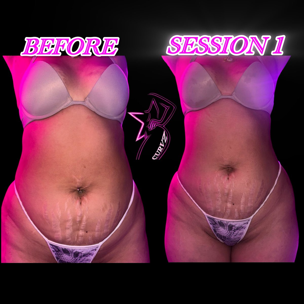 EXOTICMAMISNOW's tweet photo. Body Sculpting Session 1😍 #bodysculpting #bodypostivity #losangeles #booknow #viral https://t.co/6naEqjA01D