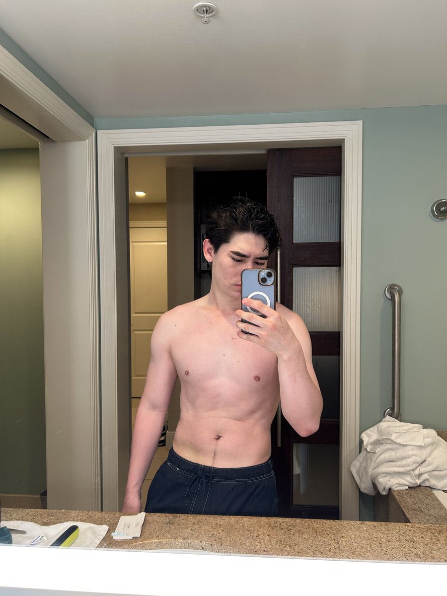 kaixsamaa's tweet photo. this visit home got me a little burnt 🫣 https://t.co/FkfEz2euhy