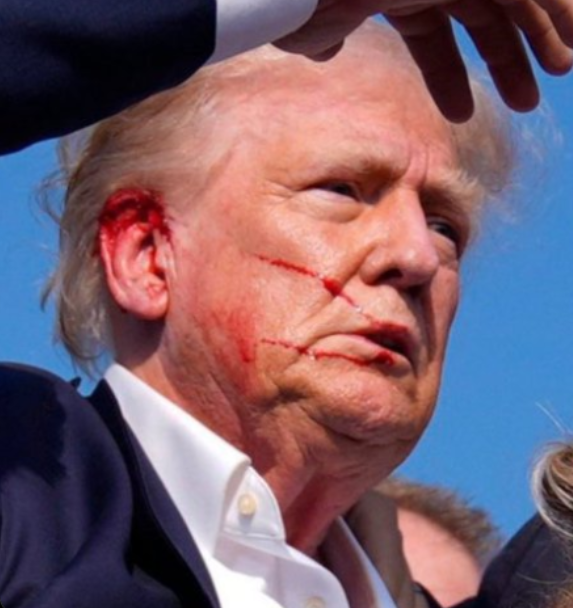 Susan38985738's tweet photo. @RossKneeDeep Watch how some SS agents will become famous and rich, it's the payola for playing along with the #scam to #fool #MAGA #GOP #RepublicanPoliticians voters.
Note the gunshot to his ear stops bleeding after one minute. #Odd https://t.co/FjZ5qrUtD3