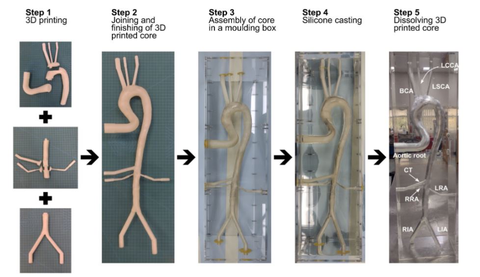 ArtifOrgans's tweet image. Visualizing Flow Dynamics in a Human #Aorta During Peripheral #VAECMO Treatment Through Particle Image #Velocimetry Study
👉tinyurl.com/4jnx56k5
@Tpchlibrary🇦🇺| #PulsatileFlow #PIV #ECMO