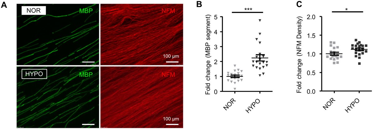 New in JBC press: "Scientists' findings identify HIF1α as a novel regulator of Schwann cell myelination and nerve repair."
Learn more:
jbc.org/article/S0021-…