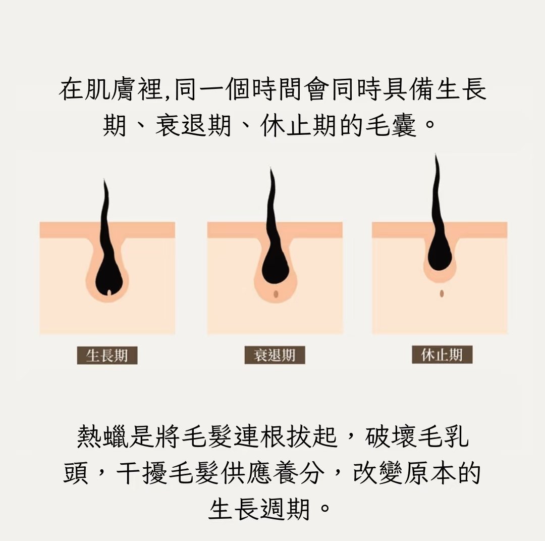 chermay8889's tweet photo. 多久做一次熱蠟除毛？
桃園中壢區熱蠟除毛
⊹含衛浴設備可供沐浴
⊹拋棄式木棒、不回鍋沾
⊹贈送去角質、保養品體驗組
預約LINE @chermay8889 
#除毛 #熱蠟除毛 #中壢 #VIO除毛 #腋下除毛 #低通感除毛 #光滑皮膚 https://t.co/P7aNzPWNcX