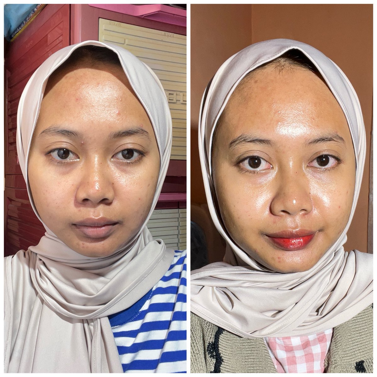 Combo ter-mantul Vitamin C + Glutabright + Ferulic Serum buat mencerahkan dan memudarkan dark spot👌😚🏅💸 

Buat redness juga bener bener bikin calming bgt, dan kulit jauh lebih glowing 
#racuninskincare