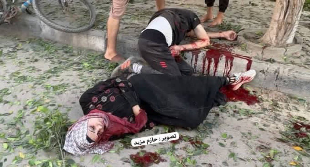 Death toll among children and their mothers KILLED in Israeli bombing while getting nutrients in Deir al Balah this morning rises to 21 
Wounded: 27