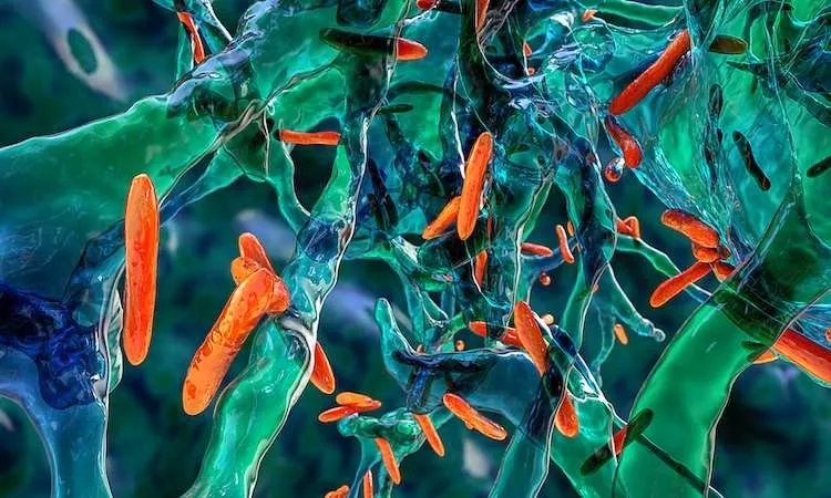 Drug Discovery World (@ddwjournal) on Twitter photo Research opens up new avenue for tuberculosis drug discovery
ddw-online.com/research-opens…
#Tuberculosis Research opens up new avenue for tuberculosis drug discovery
ddw-online.com/research-opens…
#Tuberculosis