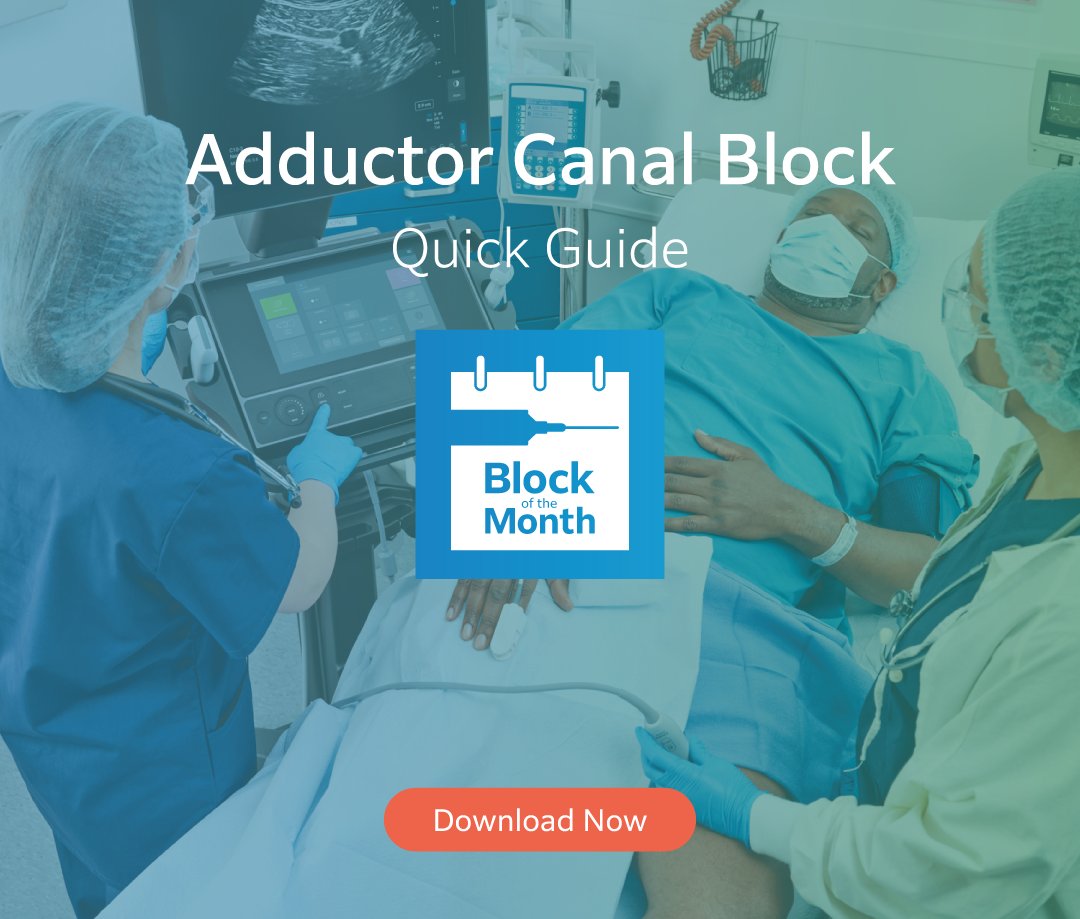 Our adductor Canal Block includes techniques with:

• Transducer positioning
• Sonographic anatomy
• Needle guidance

This guide features detailed illustrations and sonographic images to support accurate post-operative analgesia.

Access the guide below: