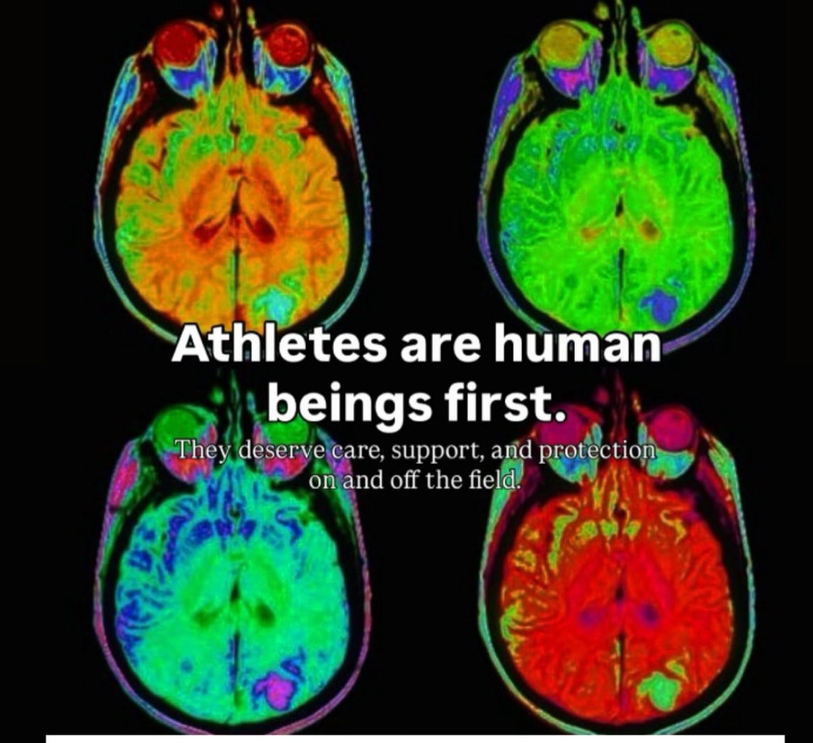 StopCTE's tweet image. 