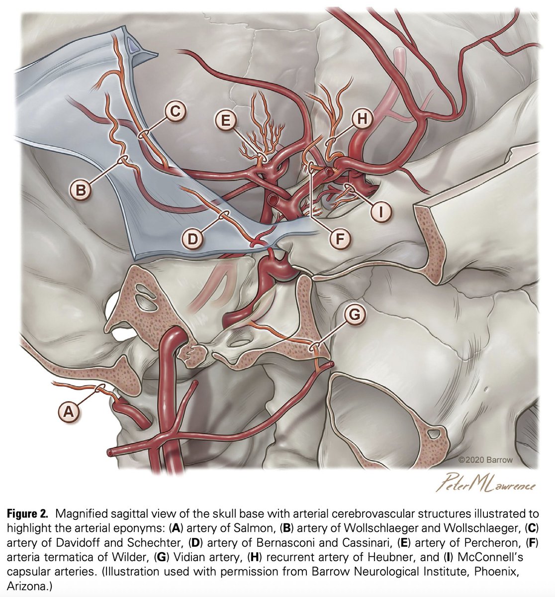 S_Pesch's tweet image. Some of the more and less well-known #eponyms of #cerebral and #spinal #arteries. 
Did I forget anything? 
For further reading, I recommend this interesting article:
doi.org/10.1016/j.wneu…

@PeterMLawrence1 @neuroangio1 @Taka_Tamaso @Michihiro1966 
#aneurysm #neurosurgery…